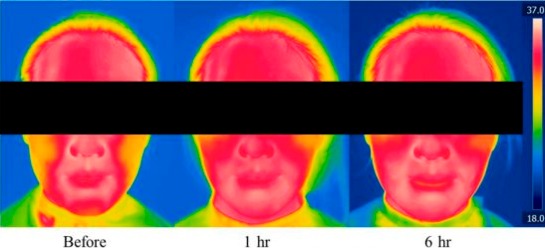 ▲마스크 착용 시간에 따른 피부 온도 변화.